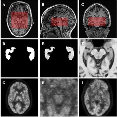 Diagnosis of Alzheimer’s Disease via Multi-Modality 3D Convolutional Neural Network